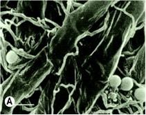 Interazione Trichoderma –pianta nella lotta biologica